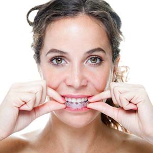 woman with clear aligner